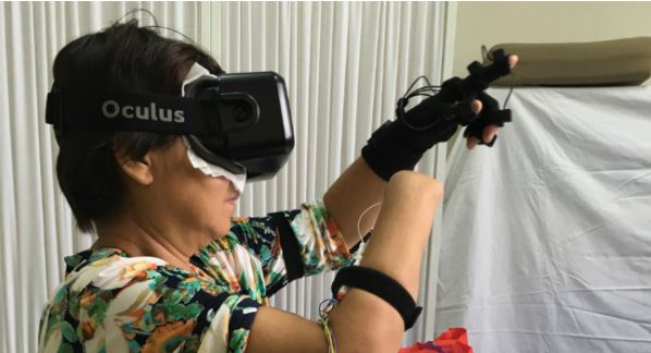 Virtual Reality can relieve phantom limb pain